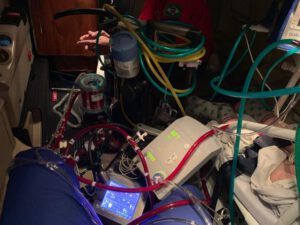Equipamento ECMO da Brasil Vida