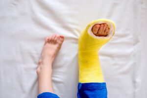 Fratura Óssea: cuidados ao tomar durante o voo - Brasil Vida
